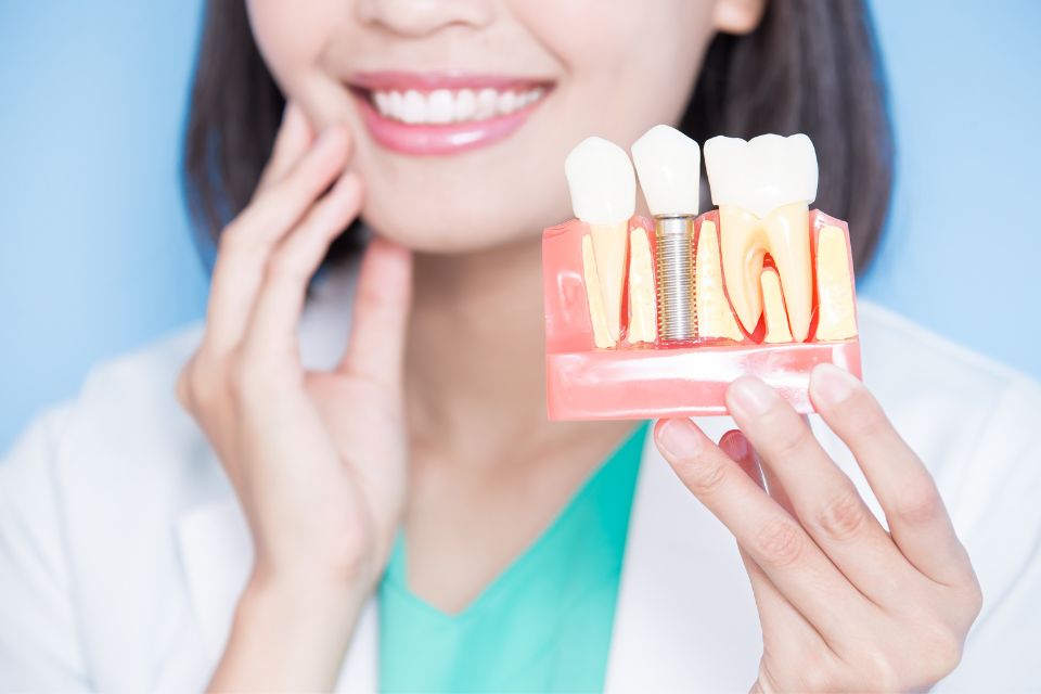All-on-4全口速定植牙是什麼？全口速定植牙手術流程、費用、優缺點一篇就懂！