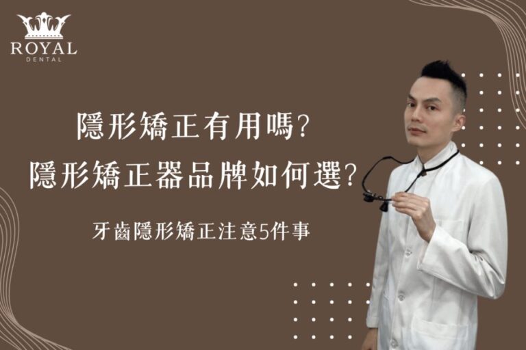 隱形矯正有用嗎？隱形矯正器品牌如何選？牙齒隱形矯正注意5件事