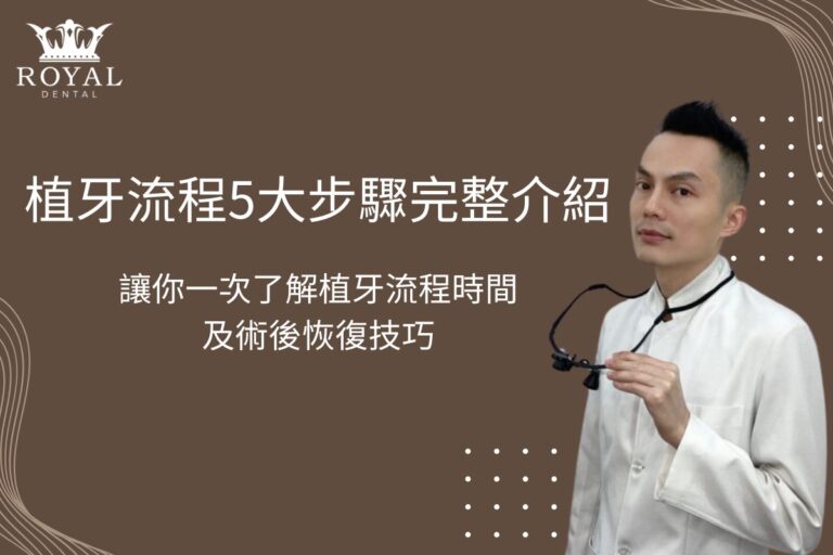 植牙流程5大步驟完整介紹,讓你一次了解植牙流程時間及術後恢復技巧 1 植牙流程5大步驟完整介紹,讓你一次了解植牙流程時間及術後恢復技巧
