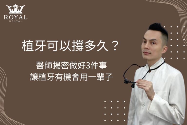 植牙可以撐多久?醫師揭密做好3件事讓植牙有機會用一輩子 1 植牙可以撐多久?醫師揭密做好3件事讓植牙有機會用一輩子