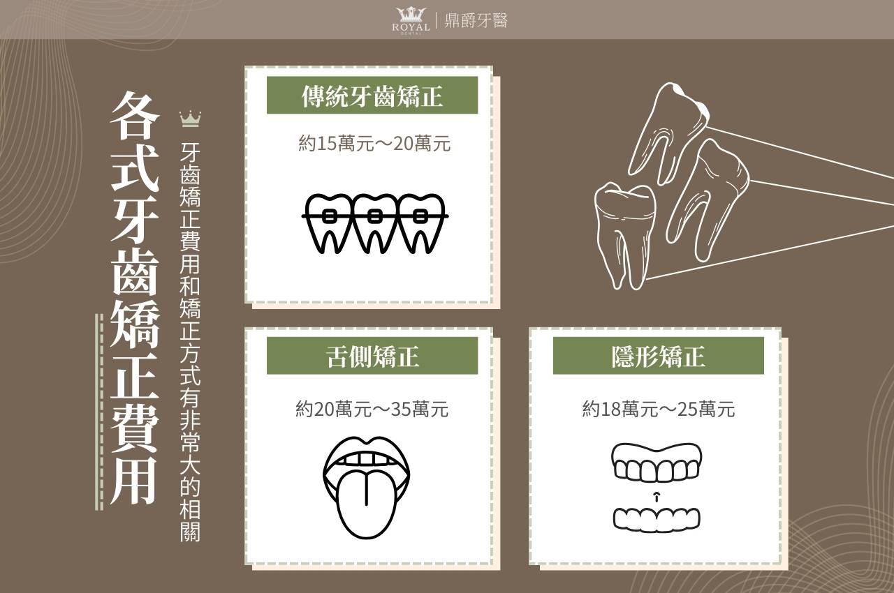 最新!牙齒矯正費用為何差這麼多?3大牙齒矯正器價格表、優缺總整理 1 最新!牙齒矯正費用為何差這麼多?3大牙齒矯正器費用、優缺總整理