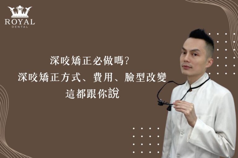 深咬矯正必做嗎?深咬矯正方式、費用、臉型改變這裡都跟你說 1 深咬矯正必做嗎?深咬矯正方式、費用、臉型改變這裡都跟你說